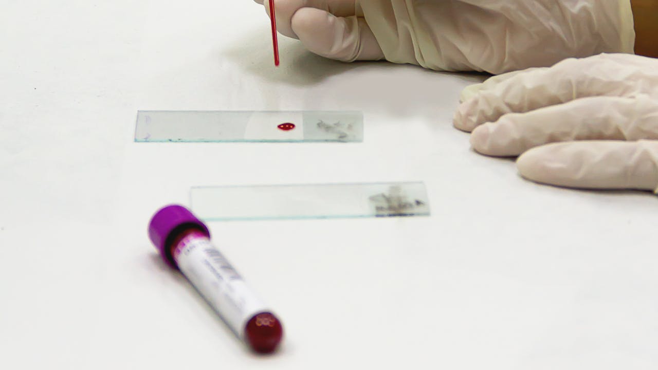 Person having blood drawn for a lab test