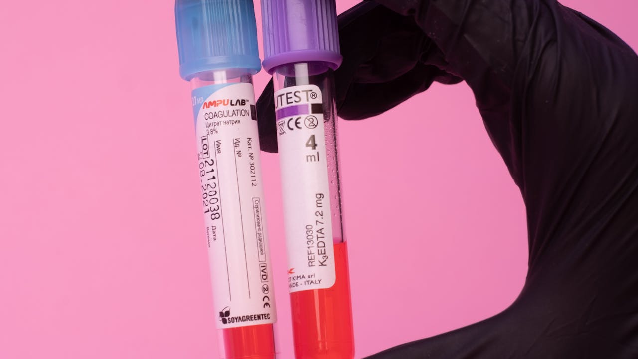 Blood test vials in a medical lab, representing the importance of biomarker tracking